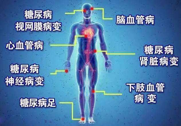 联合国糖尿病日